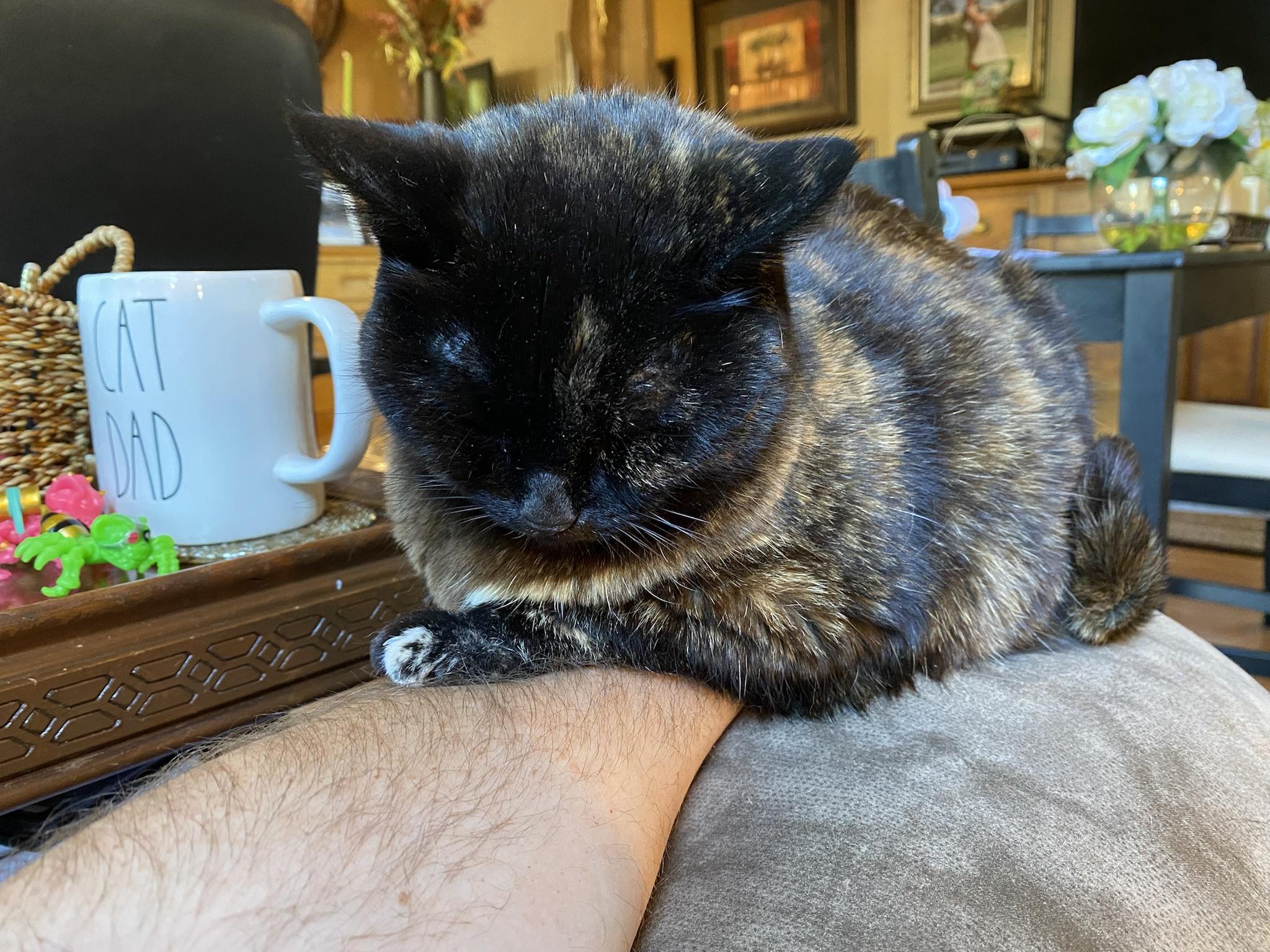 I lost my hand in a vicious animal attack