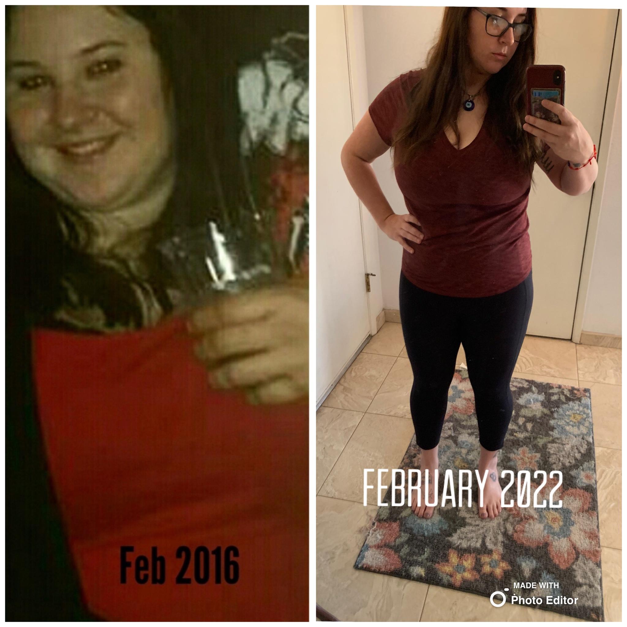 Progress with hypothyroidism