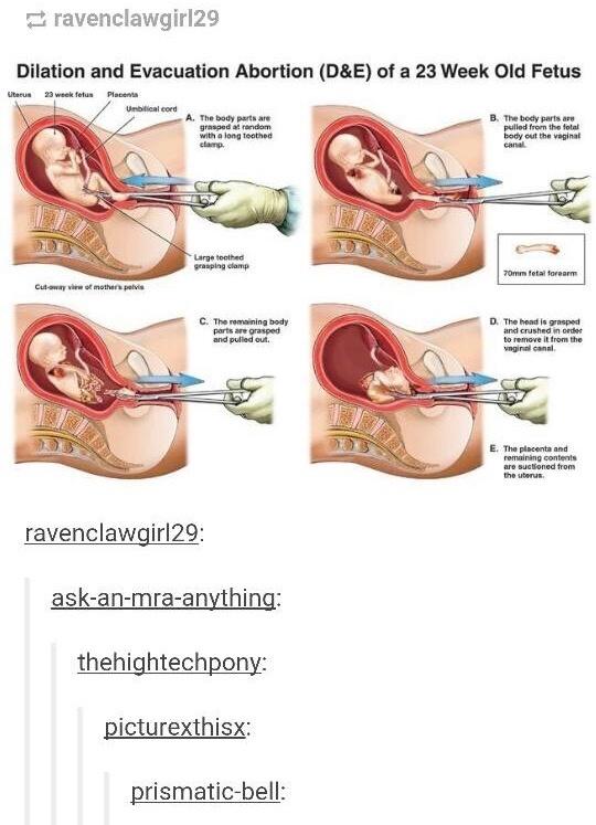 12th Favorite: "This is why I have always been, and will continue to be, pro-choice"