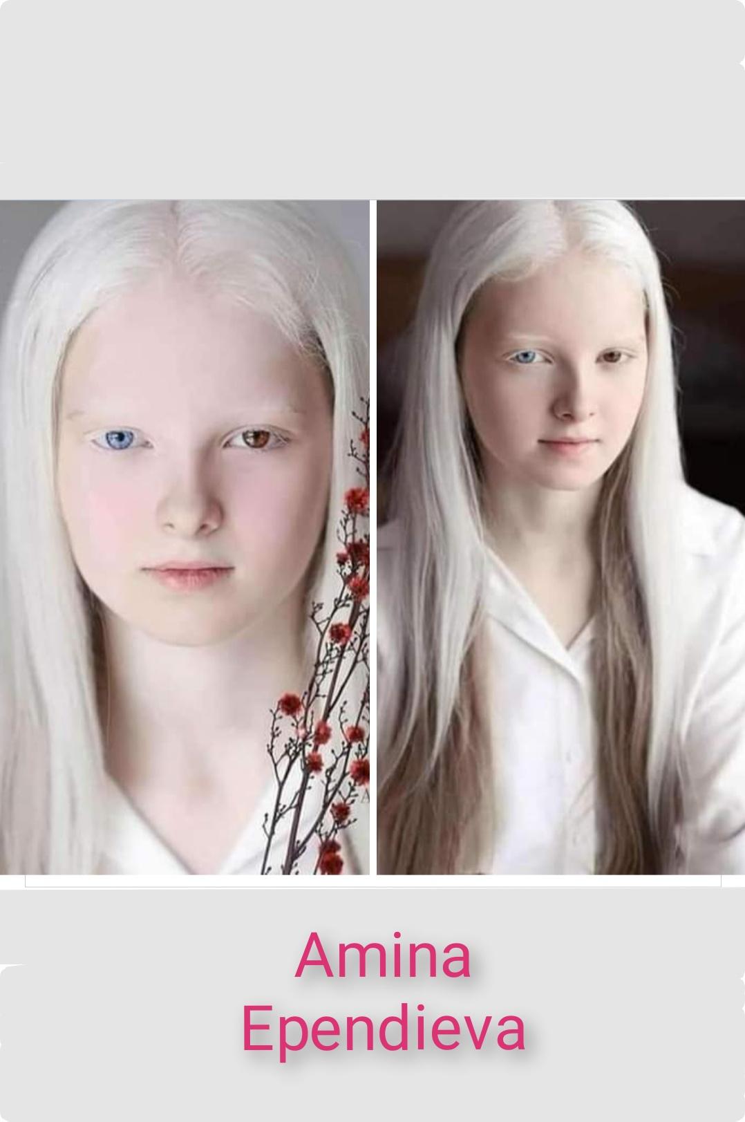 She has 2 rare genetic mutations