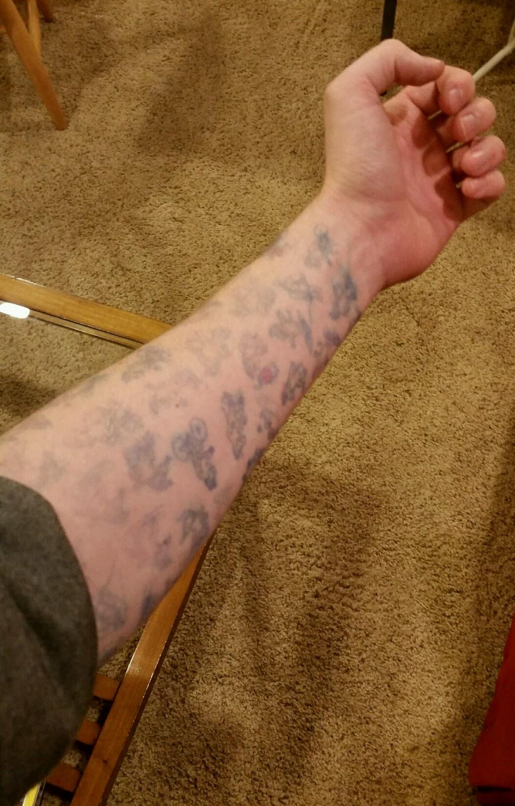 Woke up with my arm looking like this after my COVID shot